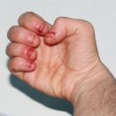 Habit and impulse disorders