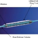 Implant (medicine)