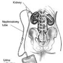 Interventional radiology