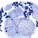 Neuropathology