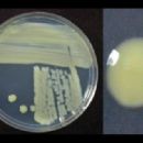 Bacteria described in 1917