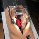 Vascular surgery