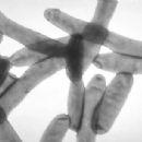 1990s disease outbreaks