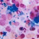 Hematopoiesis