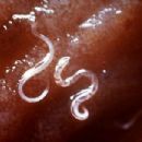 Conditions diagnosed by stool test