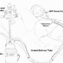 Mechanical ventilation