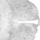 Immunohistochemistry