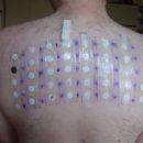 Immunologic tests