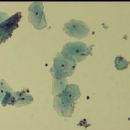 Bacteria described in 1955
