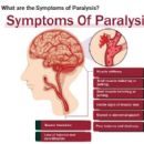 Paralysis