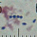 Bacteria described in 1919