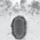 Bacteria described in 1982
