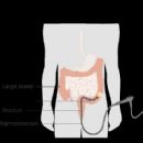 Diagnostic gastroenterology