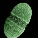Bacteria described in 1906