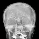 Neurology procedures