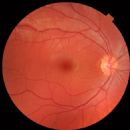 Diagnostic ophthalmology