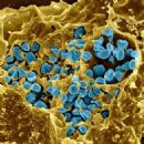 Bacteria described in 1912