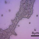 Bacteria described in 1995