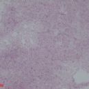 Bacteria described in 1988