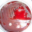 Bacteria described in 1959