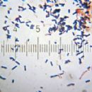 Bacteria described in 1970