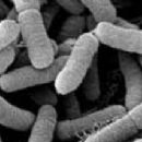 Bacteria described in 1987