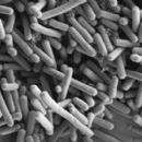 Bacteria described in 1992