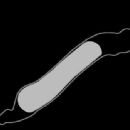 Bacteria described in 1986