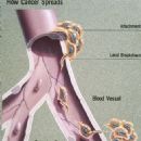 Cancer pathology