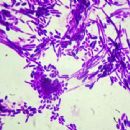 Fungi described in 1995