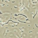 Bacteria described in 1976