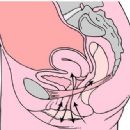 Obstetrical and gynaecological procedures
