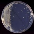 Bacteria described in 1980