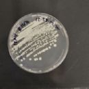 Bacteria described in 1991