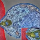 Vaccine-preventable diseases