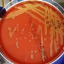 Bacteria described in 1946