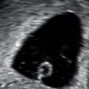 Congenital disorders